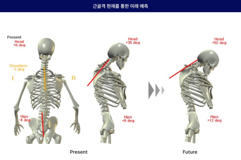 엑스바디 기업체 사내 피트니스센터 헬스장 도입