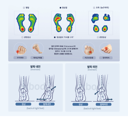 검사 결과 판독 레퍼런스