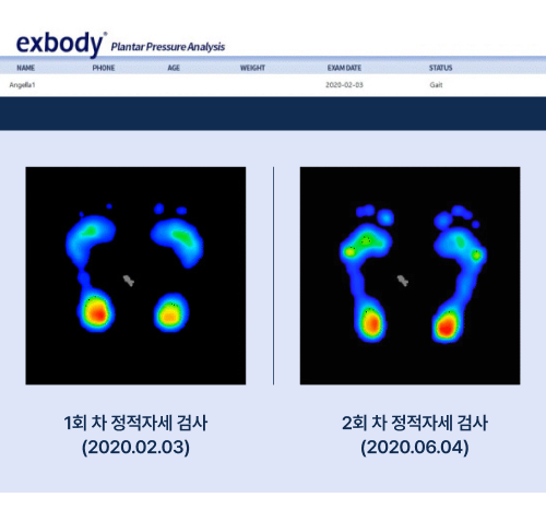 전/후 비교